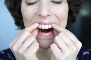 La ortodoncia invisible: la moda que no incomoda